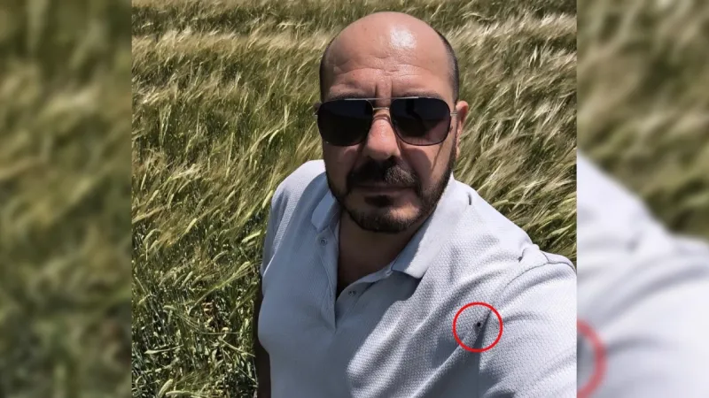 Kene Alarmı! Fotoğraf Sayesinde Fark Etti: Aşırı Fazla!
